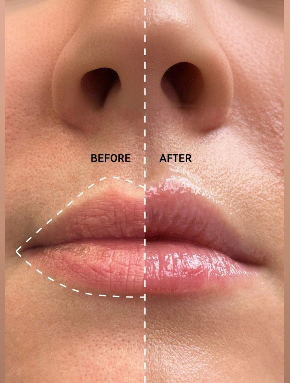 Lip Care Kit – Polish • Plump • Glow